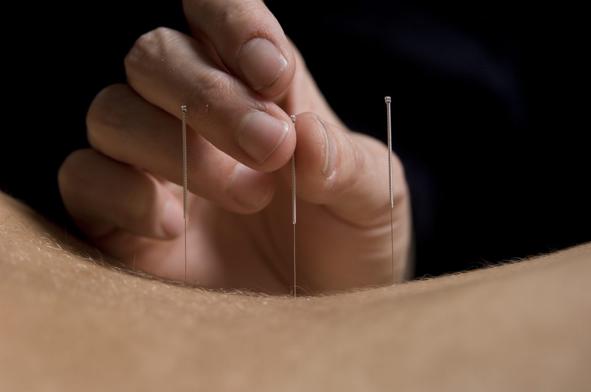 Paul Blacker acupuncture treatments