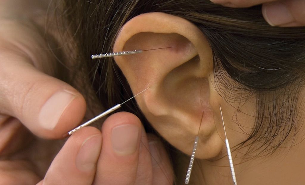 Paul Blacker acupuncture ear acupuncture
